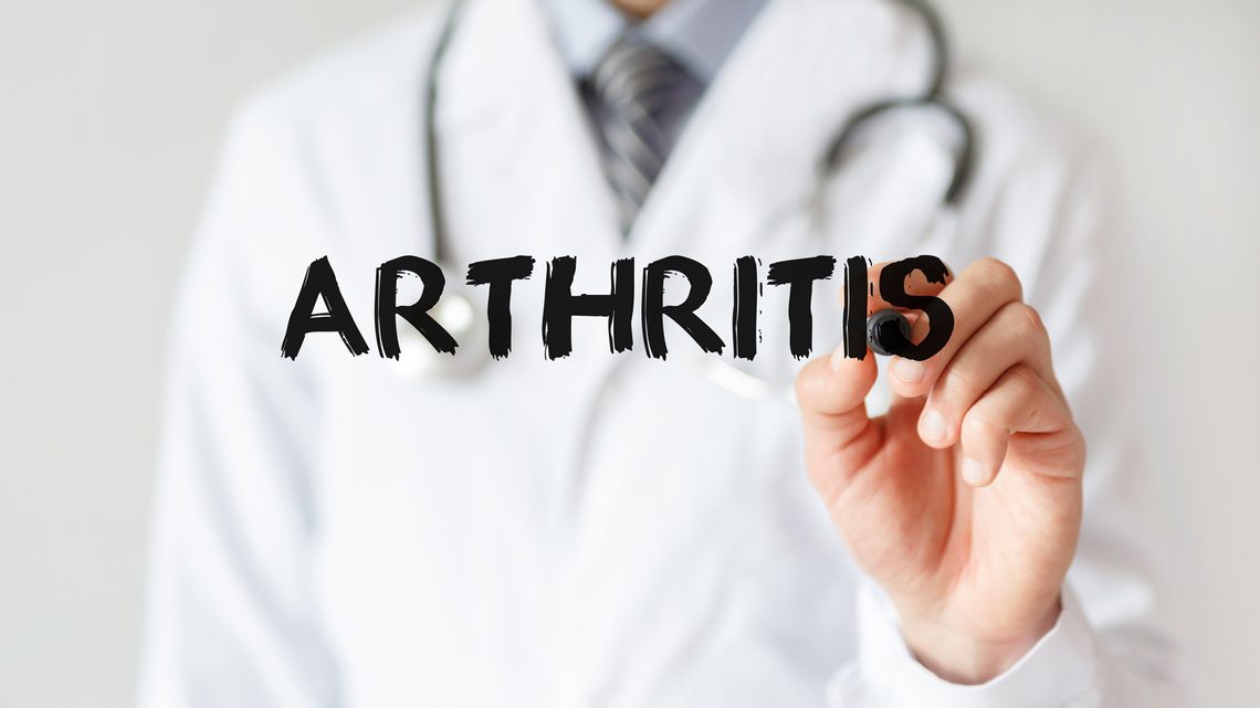 Arthritis ist der Fachbegriff für Gelenkentzündung